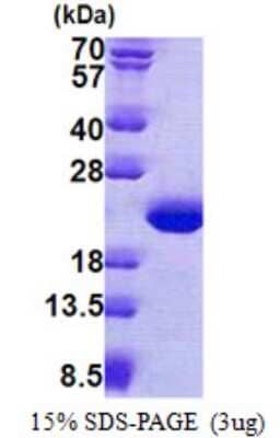 SDS-PAGE Recombinant Human TPPP3 His Protein