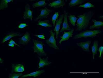 Immunocytochemistry/Immunofluorescence: TPR Antibody (1F8) [H00007175-M05] - Analysis of monoclonal antibody to TPR on HeLa cell. Antibody concentration 10 ug/ml