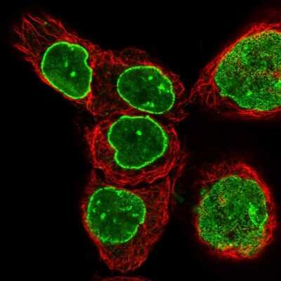 <b>Independent Antibodies Validation. </b>Immunocytochemistry/Immunofluorescence: TPR Antibody [NBP1-89448] - Staining of human cell line A-431 shows localization to nuclear membrane.