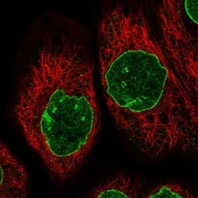 Immunocytochemistry/Immunofluorescence: TPR Antibody [NBP1-89451] - Immunofluorescent staining of human cell line A-431 shows localization to nuclear membrane. Antibody staining is shown in green.