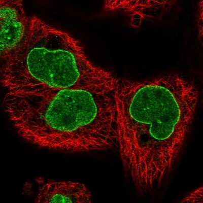 Immunocytochemistry/Immunofluorescence: TPR Antibody [NBP1-89452] - Immunofluorescent staining of human cell line A-431 shows localization to nuclear membrane.