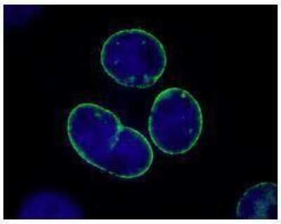 Immunocytochemistry/ Immunofluorescence TPR Antibody