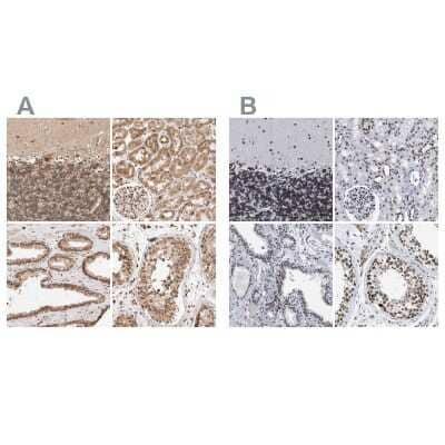 Immunohistochemistry-Paraffin: TPR Antibody [NBP1-89448] - Staining of human cerebellum, kidney, prostate and testis using Anti-TPR antibody NBP1-89448 (A) shows similar protein distribution across tissues to independent antibody NBP1-89452 (B).