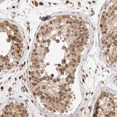 Immunohistochemistry-Paraffin: TPR Antibody [NBP1-89448] - Staining of human testis shows moderate positivity in nuclear membrane in cells in seminiferous ducts.