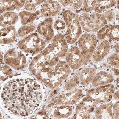 Immunohistochemistry-Paraffin: TPR Antibody [NBP1-89448] - Staining of human kidney shows moderate positivity in nuclear membrane in cells in tubules.