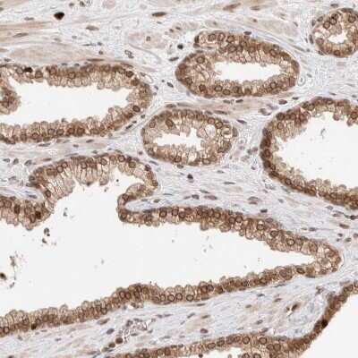 Immunohistochemistry-Paraffin: TPR Antibody [NBP1-89448] - Staining of human prostate shows strong positivity in nuclear membrane in glandular cells.