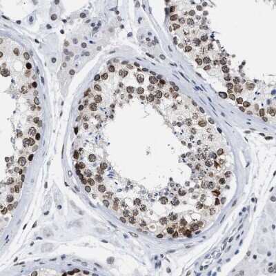 Immunohistochemistry-Paraffin: TPR Antibody [NBP1-89451] - Staining of human testis shows moderate positivity in nuclear membrane in cells in seminiferous ducts.