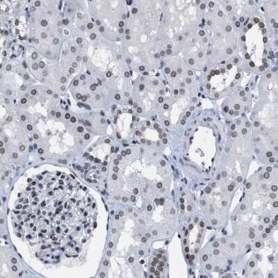 Immunohistochemistry-Paraffin: TPR Antibody [NBP1-89451] - Staining of human kidney shows moderate positivity in nuclear membrane in cells in tubules.