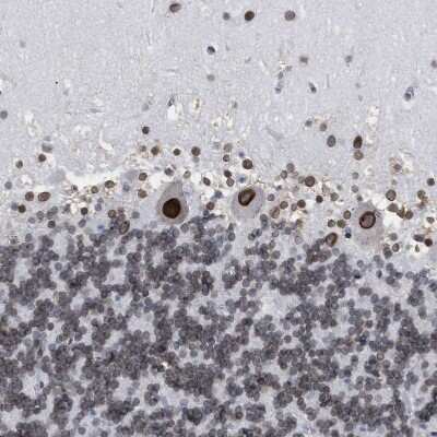 Immunohistochemistry-Paraffin: TPR Antibody [NBP1-89451] - Staining of human cerebellum shows strong positivity in nuclear membrane in Purkinje cells.