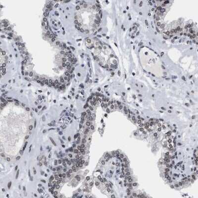 Immunohistochemistry-Paraffin: TPR Antibody [NBP1-89451] - Staining of human prostate shows moderate positivity in nuclear membrane in glandular cells.