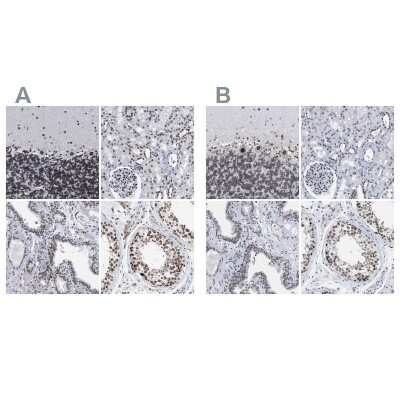 <b>Independent Antibodies Validation. </b>Immunohistochemistry-Paraffin: TPR Antibody [NBP1-89452] - Staining of human cerebellum, kidney, prostate and testis using Anti-TPR antibody NBP1-89452 (A) shows similar protein distribution across tissues to independent antibody NBP1-89451 (B).