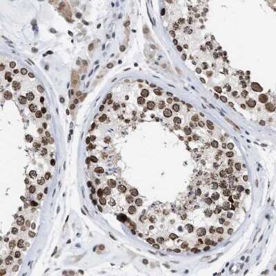 Immunohistochemistry-Paraffin: TPR Antibody [NBP1-89452] - Staining of human testis shows strong positivity in nuclear membrane in cells in seminiferous ducts.