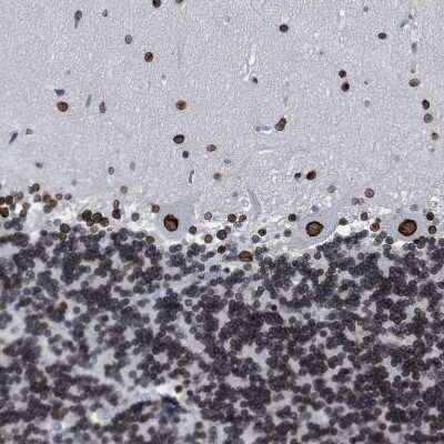 Immunohistochemistry-Paraffin: TPR Antibody [NBP1-89452] - Staining of human cerebellum shows strong positivity in nuclear membrane in Purkinje cells.
