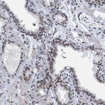 Immunohistochemistry-Paraffin: TPR Antibody [NBP1-89452] - Staining of human prostate shows strong positivity in nuclear membrane in glandular cells.