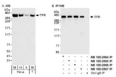 Immunoprecipitation: TPR Antibody [NB100-2867] - Detection of Human TPR on HeLa whole cell lysate using NB100-2867. TPR was also immunoprecipitated by rabbit anti-TPR  antibodies NB100-2864, NB100-2865 and NB100-2866.