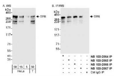 <b>Independent Antibodies Validation and Biological Strategies Validation.</b>Western Blot: TPR Antibody [NB100-2864] - Detection of Human TPR on HeLa whole cell lysate using NB100-2864. TPR was also immunoprecipitated by rabbit anti-TPR antibodies NB100-2865, NB100-2866 and NB100-2867.