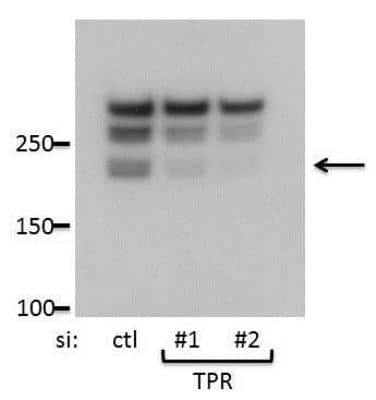 Western Blot: TPR Antibody [NB100-2864] - Extracts from human cancer (HCC44) cell line. Image from verified customer review.
