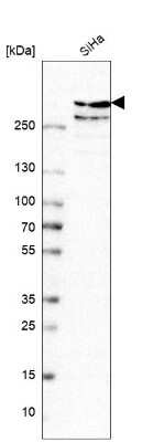 Western Blot: TPR Antibody [NBP1-89451] - Analysis in human cell line SiHa.