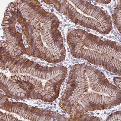 Immunohistochemistry-Paraffin: TPRG1 Antibody [NBP2-13471] - Staining of human stomach, upper shows distinct cytoplasmic and membranous positivity in glandular cells.