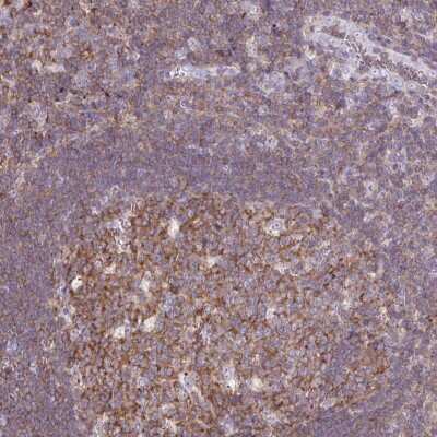 Immunohistochemistry-Paraffin: TPRG1 Antibody [NBP2-49311] - Staining of human tonsil shows moderate cytoplasmic positivity in germinal center cells.