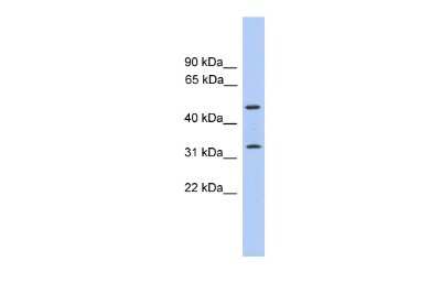 Western Blot: TPRG1 Antibody [NBP2-88450] - WB Suggested Anti-FAM79B Antibody Titration: 0.2-1 ug/ml. ELISA Titer: 1:312500. Positive Control: Human Placenta
