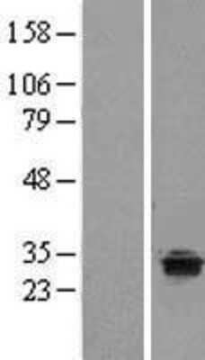 Western Blot: TPRG1 Overexpression Lysate (Adult Normal) [NBL1-17227] Left-Empty vector transfected control cell lysate (HEK293 cell lysate); Right -Over-expression Lysate for TPRG1.
