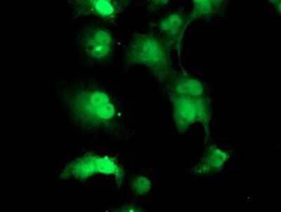 Immunocytochemistry/Immunofluorescence: TPRKB Antibody (3H3) [NBP2-03885] - Staining of COS7 cells transiently transfected by pCMV6-ENTRY TPRKB.