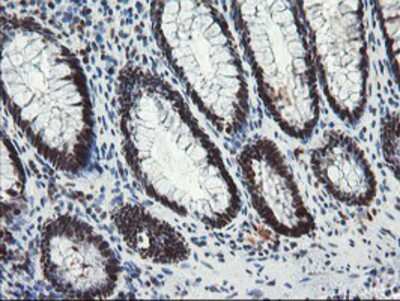 Immunohistochemistry-Paraffin: TPRKB Antibody (3H3) [NBP2-03885] - Staining of paraffin-embedded Human colon tissue using anti-TPRKB mouse monoclonal antibody.