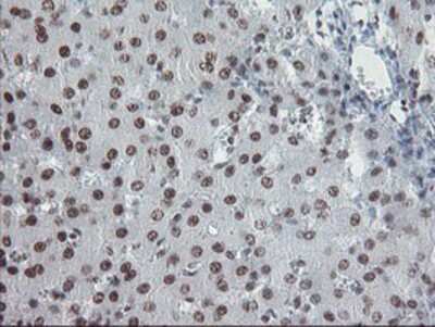 Immunohistochemistry-Paraffin: TPRKB Antibody (3H3) [NBP2-03885] - Staining of paraffin-embedded Human liver tissue using anti-TPRKB mouse monoclonal antibody.