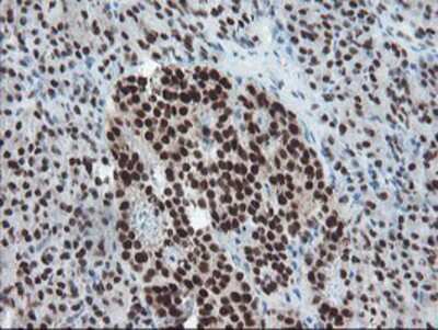 Immunohistochemistry-Paraffin: TPRKB Antibody (3H3) [NBP2-03885] - Staining of paraffin-embedded Human pancreas tissue using anti-TPRKB mouse monoclonal antibody.