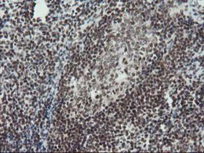 Immunohistochemistry-Paraffin: TPRKB Antibody (3H3) [NBP2-03885] - Staining of paraffin-embedded Human tonsil using anti-TPRKB mouse monoclonal antibody.