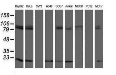 Western Blot: TPRKB Antibody (3H3) [NBP2-03885] Analysis of extracts (35ug) from 9 different cell lines by usin g anti-TPRKB monoclonal antibody (HepG2: human; HeLa: human; SVT2: mouse; A549: human; COS7: monkey; Jurkat: human; MDCK: canine; PC12: rat; MCF7: human).