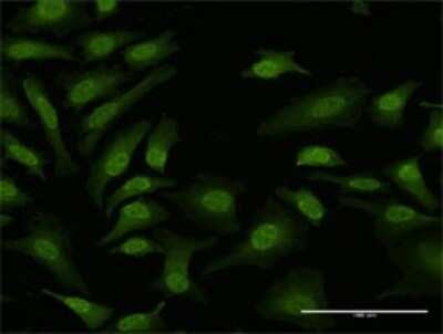 Immunocytochemistry/Immunofluorescence: TPRKB Antibody [H00051002-D01P] - Analysis of antibody to TPRKB on HeLa cell. Antibody concentration 10 ug/ml.