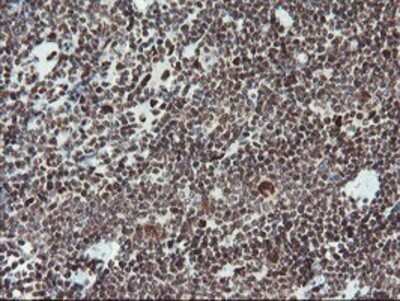 Immunohistochemistry: TPRKB Antibody (OTI3H3) - Azide and BSA Free [NBP2-74574] - Staining of paraffin-embedded Human lymphoma tissue using anti-TPRKB mouse monoclonal antibody.