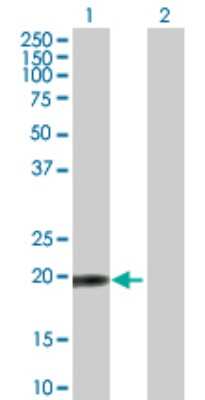 Western Blot: TPRKB Antibody [H00051002-B01P] - Analysis of TPRKB expression in transfected 293T cell line by TPRKB polyclonal antibody.  Lane 1: CGI-121 transfected lysate(19.25 KDa). Lane 2: Non-transfected lysate.