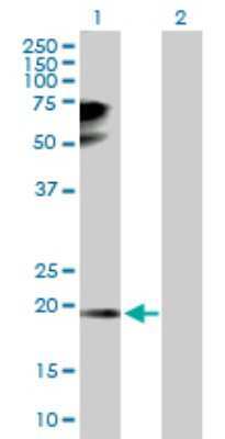 Western Blot: TPRKB Antibody [H00051002-D01P] - Analysis of TPRKB expression in transfected 293T cell line by TPRKB polyclonal antibody.Lane 1: TPRKB transfected lysate(19.70 KDa).Lane 2: Non-transfected lysate.