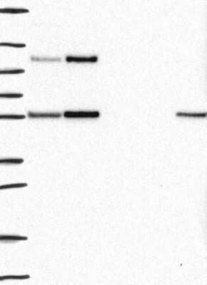 Western Blot: TPRN Antibody [NBP3-17181] - Lane 1: Marker [kDa] 250, 130, 95, 72, 55, 36, 28, 17, 10;   Lane 2: RT4;   Lane 3: U-251 MG;   Lane 4: Human Plasma;   Lane 5: Liver;   Lane 6: Tonsil