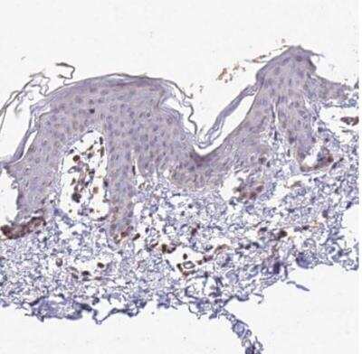 Immunohistochemistry-Paraffin: TPRX1 Antibody [NBP1-92524] - Staining of human skin shows no positivity in squamous epithelial cells as expected.
