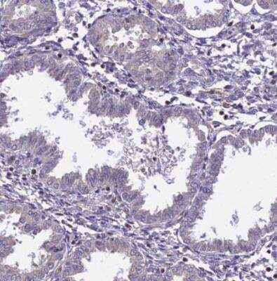 Immunohistochemistry-Paraffin: TPRX1 Antibody [NBP1-92524] - Staining of human endometrium shows no positivity in glandular cells as expected.