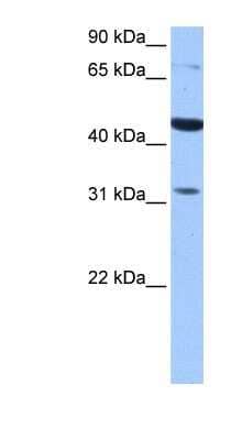 Western Blot: TPRXL Antibody [NBP1-91423] - HepG2 cell lysate, concentration 0.2-1 ug/ml.