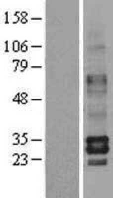 Western Blot Tryptase beta-2/TPSB2 Overexpression Lysate