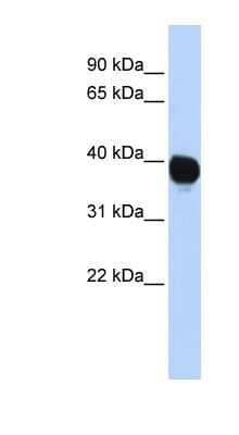 Western Blot: TPST2 Antibody [NBP1-60025] - HepG2 cell lysate, concentration 0.2-1 ug/ml.