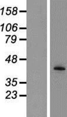 Western Blot: TPST2 Overexpression Lysate (Adult Normal) [NBP2-07978] Left-Empty vector transfected control cell lysate (HEK293 cell lysate); Right -Over-expression Lysate for TPST2.