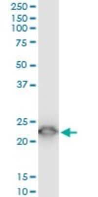 Western Blot: TPT1/TCTP Antibody (2C4) [H00007178-M03] - Analysis of TPT1 expression in PC-12 (Cat # L012V1).