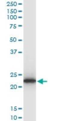 Western Blot: TPT1/TCTP Antibody (2C4) [H00007178-M03] - Analysis of TPT1 expression in Raw 264.7 (Cat # L024V1).