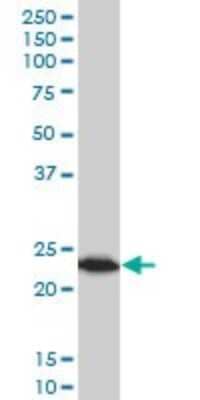 Western Blot: TPT1/TCTP Antibody (2C4) [H00007178-M03] - Analysis of TPT1 expression in MCF-7 (Cat # L046V1).