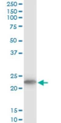 Western Blot: TPT1/TCTP Antibody (2C4) [H00007178-M03] - Analysis of TPT1 expression in NIH/3T3 (Cat # L018V1).