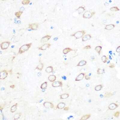 Immunohistochemistry-Paraffin: TPT1/TCTP Antibody (9H7S4) [NBP3-16122] - Immunohistochemistry of paraffin-embedded rat brain using TPT1/TCTP Rabbit mAb (NBP3-16122) at dilution of 1:100 (40x lens).Perform microwave antigen retrieval with 10 mM PBS buffer pH 7.2 before commencing with IHC staining protocol.