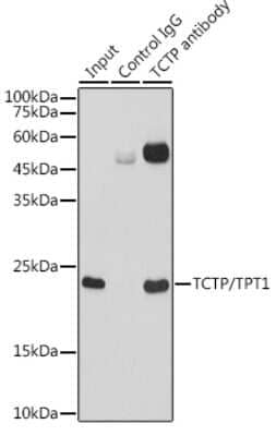 Immunoprecipitation: TPT1/TCTP Antibody (9H7S4) [NBP3-16122] - Immunoprecipitation analysis of 300ug extracts of HeLa cells using 3ug TPT1/TCTP antibody (NBP3-16122). Western blot was performed from the immunoprecipitate using TPT1/TCTP antibody (NBP3-16122) at a dilition of 1:1000.