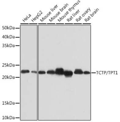 Western Blot: TPT1/TCTP Antibody (9H7S4) [NBP3-16122] - Western blot analysis of extracts of various cell lines, using TPT1/TCTP Rabbit mAb (NBP3-16122) at 1:1000 dilution. Secondary antibody: HRP Goat Anti-Rabbit IgG (H+L) at 1:10000 dilution. Lysates/proteins: 25ug per lane. Blocking buffer: 3% nonfat dry milk in TBST. Detection: ECL Basic Kit. Exposure time: 10s.